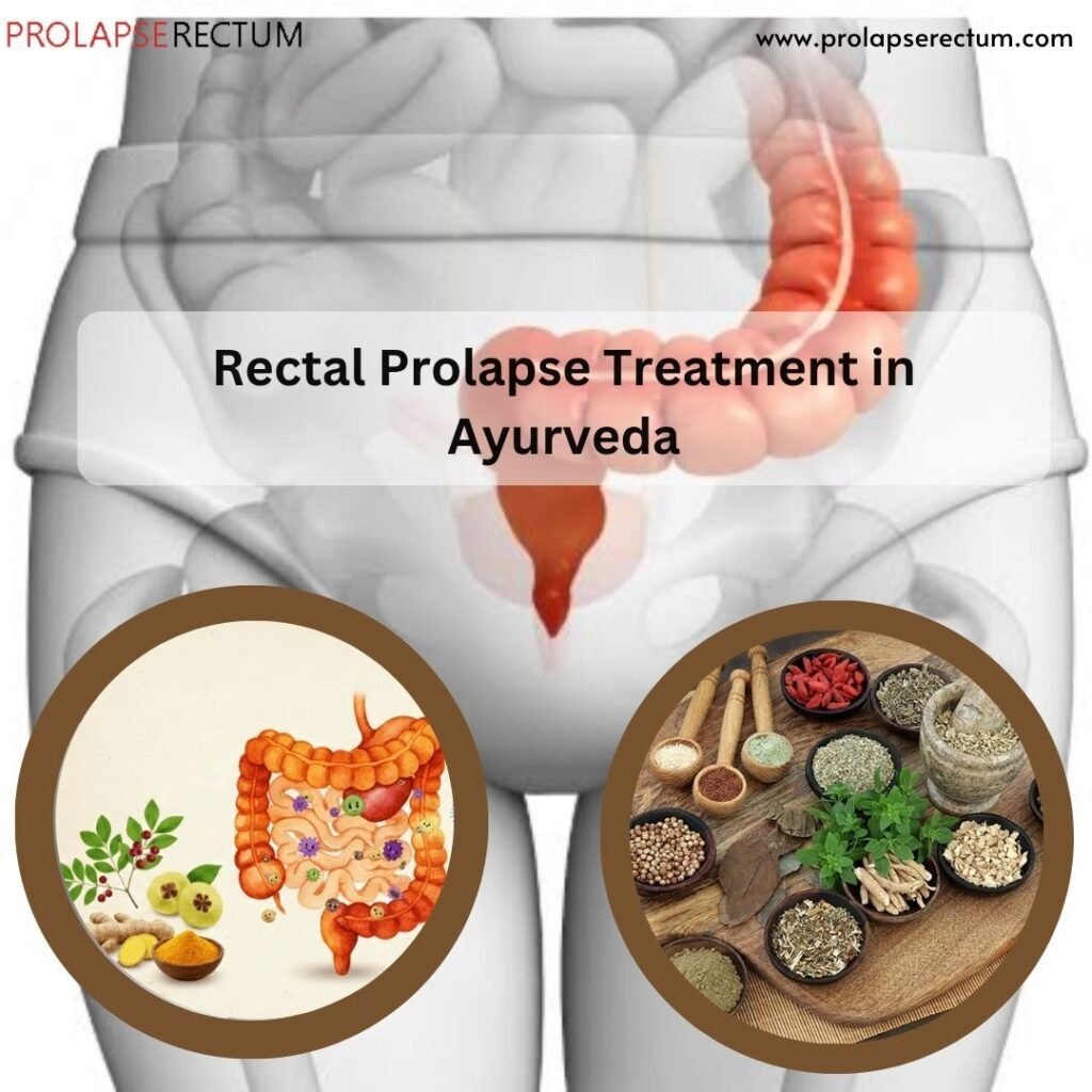 Rectal Prolapse Treatment in Ayurveda
