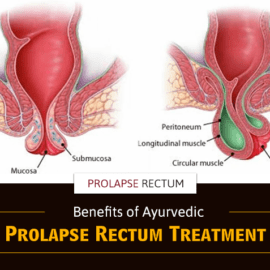 Benefits of Ayurvedic Prolapse Rectum Treatment (Used 15th Apr)