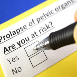 Nonsurgical Treatment for Pelvic Organ Prolapse