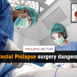 Is rectal prolapse surgery dangerous (used 27th May)