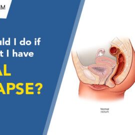 What Should I Do If I Think That I Have Rectal Prolapse
