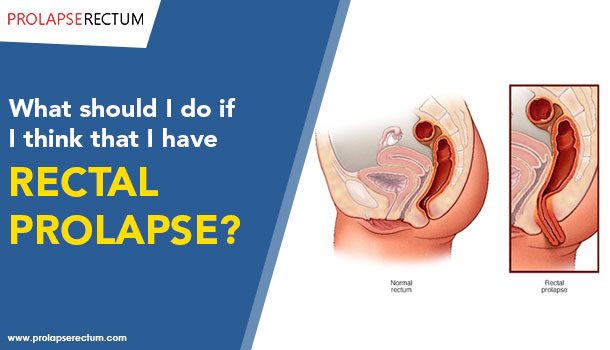 What Should I Do If I Think That I Have Rectal Prolapse What Should I Do If I Think That I Have Rectal Prolapse