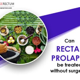 Can Rectal Prolapse Be Treated Without Surgery