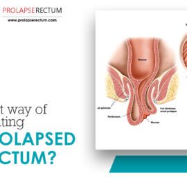 Is It Herbal Treatment Works For Prolapse Rectal?