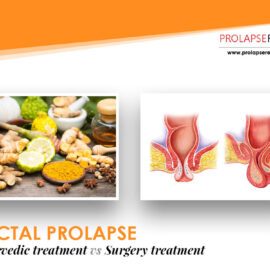 Rectal Prolapse Ayurvedic Treatment Vs. Surgery Treatment Rectal Prolapse Ayurvedic Treatment Vs. Surgery Treatment