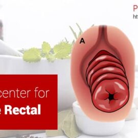 Ayurvedic Center For Prolapse Rectal Ayurvedic Center For Prolapse Rectal