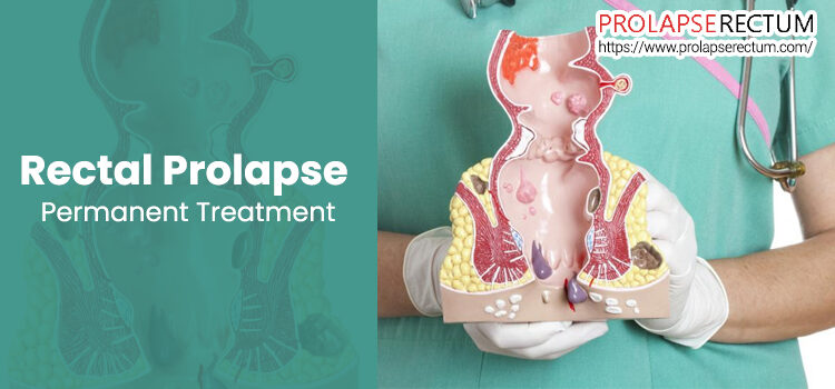 Rectal Prolapse Permanent Treatment Rectal Prolapse Permanent Treatment