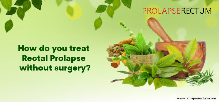 How Do You Treat Rectal Prolapse Without Surgery? Rectal Prolapse