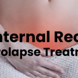Internal Rectal Prolapse Treatment