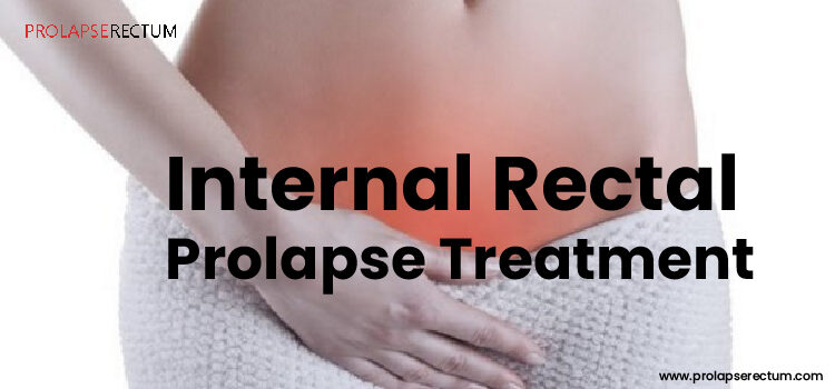 Internal Rectal Prolapse Treatment Internal Rectal Prolapse Treatment