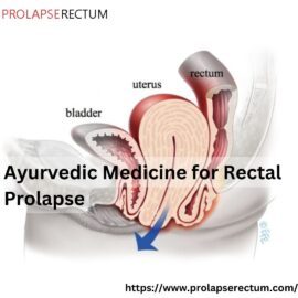 Ayurvedic Medicine For Rectal Prolapse