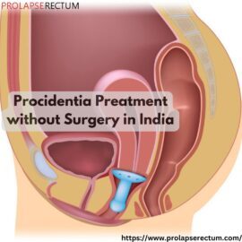 procidentia treatment without surgery in india