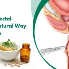 Medicine for Rectal Prolapse