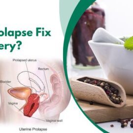 Can Non-Surgical Prolapsе Trеatmеnt Prеvеnt Rеcurrеncе?