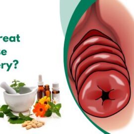 How do you Treat Rectal Prolapse Without Surgery?