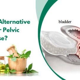 What are the Alternative Treatments for Pelvic Organ Prolapse?