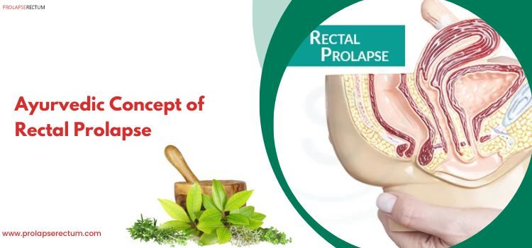A Comprehensive Look at the Ayurvedic Concept of Rectal Prolapse