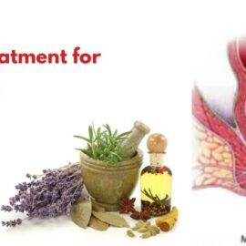Ayurvedic Treatment for Gudabhransh
