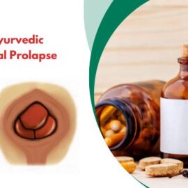Commonly Used Ayurvedic Medicines for Rectal Prolapse