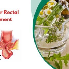 Recognizing Signs and Symptoms of Rectal Prolapse