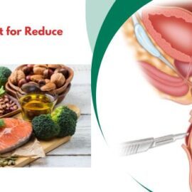 What is the Best Diet To Reduce Rectal Prolapse?