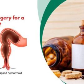 Can you Avoid Surgery for a Prolapsed Rectum