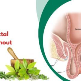 How to Fix Rectal Prolapse Without Surgery? How to Fix Rectal Prolapse Without Surgery?
