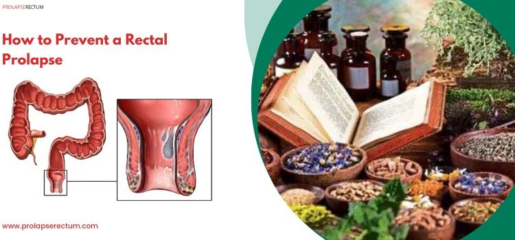 How to Prevent a Rectal Prolapse? How to Prevent a Rectal Prolapse?