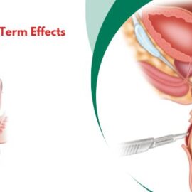 What Are the Long-Term Effects of Rectal Prolapse?