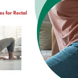 Pelvic Floor Exercises for Rectal Prolapse Pelvic Floor Exercises for Rectal Prolapse