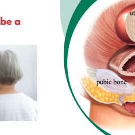 Can a Prolapse Be a Sign of Cancer? Can a Prolapse Be a Sign of Cancer?