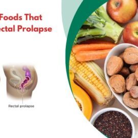 Diet and Digestion:  Foods That Can Help Relieve Rectal Prolapse Symptoms Diet and Digestion: Foods That Can Help Relieve Rectal Prolapse Symptoms
