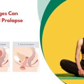 How Lifestyle Changes Can Improve Mild Rectal Prolapse Naturally?