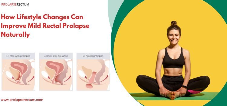 How Lifestyle Changes Can Improve Mild Rectal Prolapse Naturally?