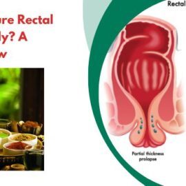 Can Ayurveda Cure Rectal Prolapse Naturally? A Detailed Overview
