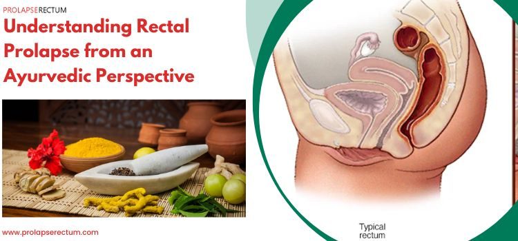 Understanding Rectal Prolapse from an Ayurvedic Perspective
