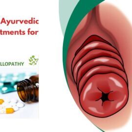 Difference Between Ayurvedic and Allopathic Treatments for Rectal Prolapse