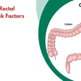 Who is at Risk of Rectal Prolapse? Key Risk Factors Explained