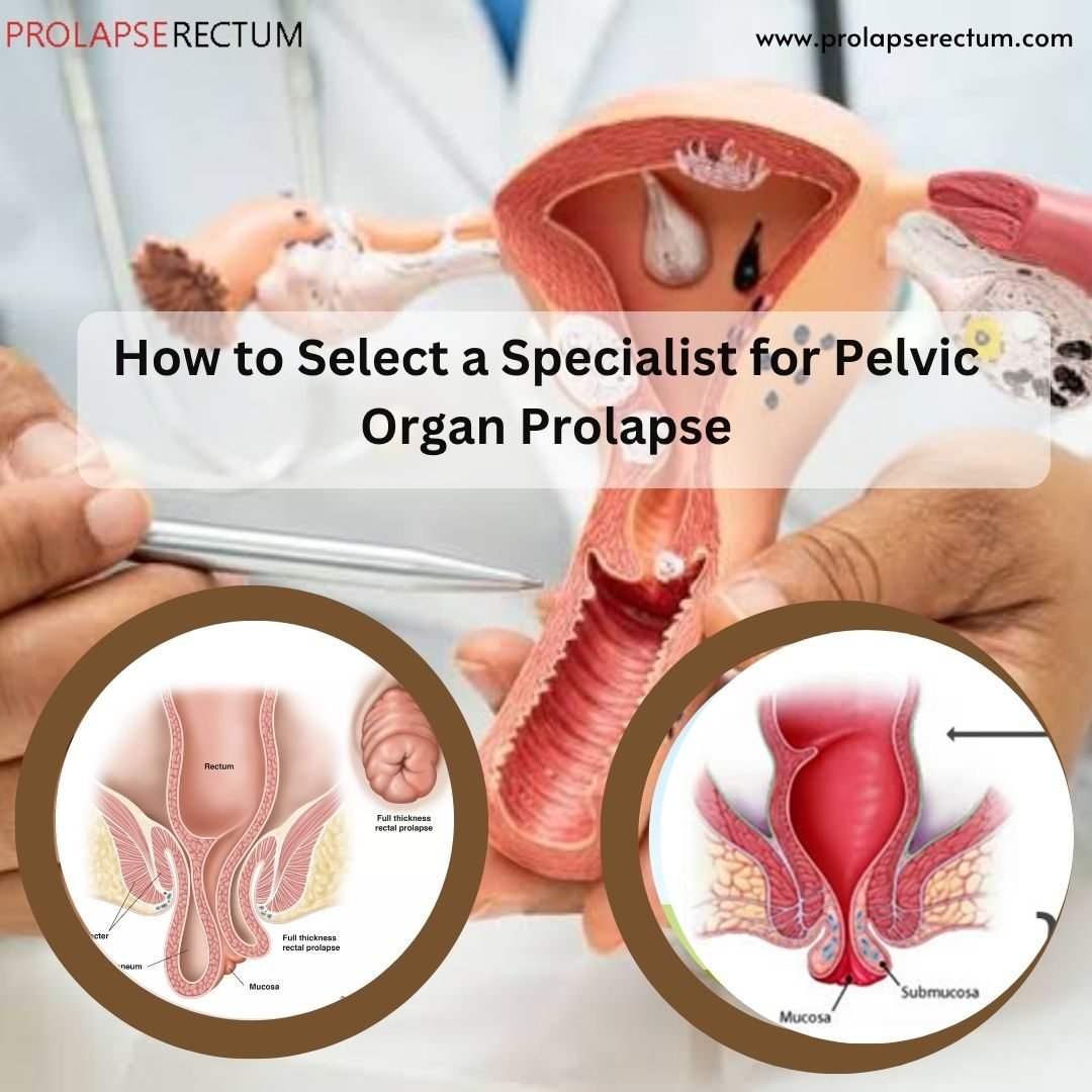 Pelvic Organ Prolapse